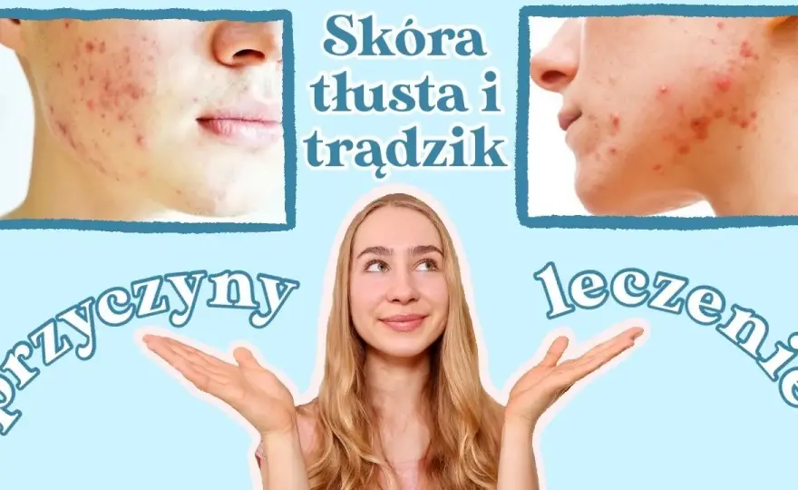 Jak skutecznie pozbyć się tłustej cery – sprawdzone metody i porady